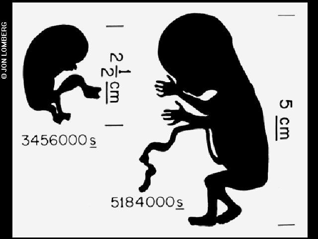 The fetus diagram image is one of the pictures electronically placed on the phonograph records which are carried onboard the Voyager 1 and 2 spacecraft. Credit: Jon Lomberg