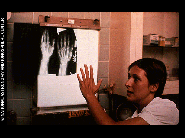 The X-ray of hand image is one of the pictures electronically placed on the phonograph records which are carried onboard the Voyager 1 and 2 spacecraft. Credit: National Astronomy and Ionosphere Center, Cornell University (NAIC)